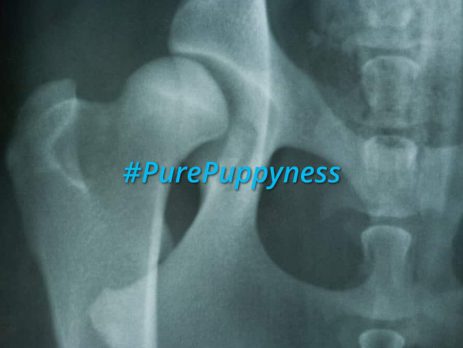 Hip Dysplasia